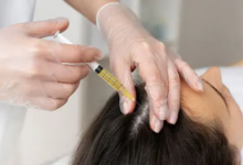 Is PRF Hair Treatment Worth the Investment?