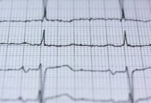 cosmic pulse dynamics analysis